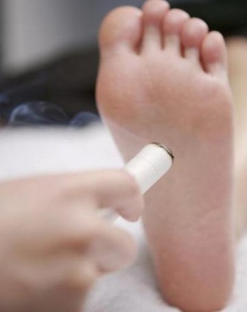 中医专家推荐十大养生要穴 可强身健体