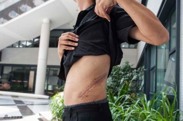 记者暗访半月揭贩肾黑幕：卖肾者仅得3万元