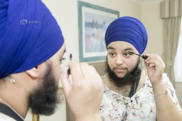 英国23岁女子长满脸络腮胡 称很性感