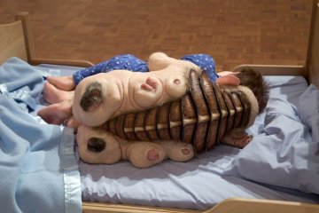 惊现“猪人”又是怪病？
