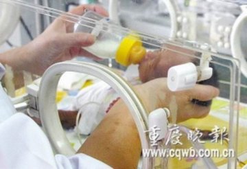 重庆超早产儿满月出生不足一公斤仅有巴掌大