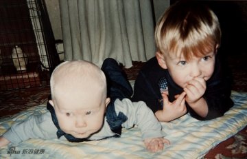 英姐弟患白化病乐享与众不同