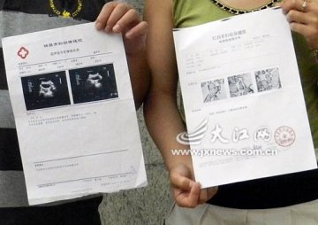 做完清宫手术胎儿仍在腹中 瑞昌市人民医院遭投诉