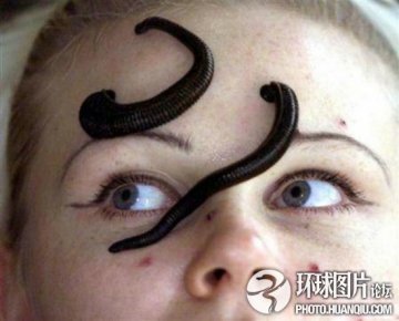 全球最不可思议的“治病”怪招 泰国用蛆治病