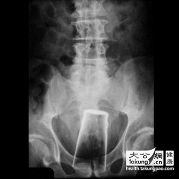 女人的私处可以放些啥