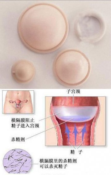 性福春节：女性新式避孕方法大全