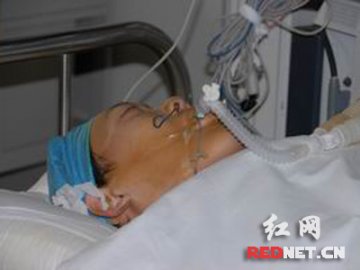 2.24米巨人接受手术摘除脑垂体腺瘤