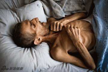 传染病死亡率排行榜中，肺结核排名第二