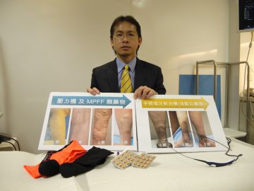 六成人患隐藏性静脉曲张