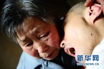 夫妇收养脑瘫儿32年不惜将亲生子送亲戚照料