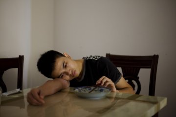 实拍卡尔曼氏综合征的生活