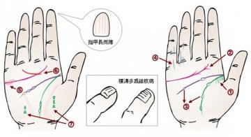 24种手相揭示疾病征兆