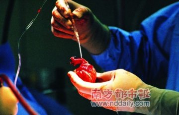 批评者认为哈佛发明脑死亡最大目的是器官移植