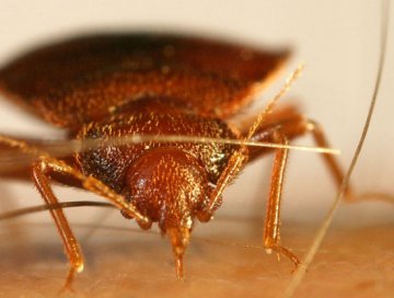 揭秘人类体毛用处：可预防寄生虫与蚊虫叮咬
