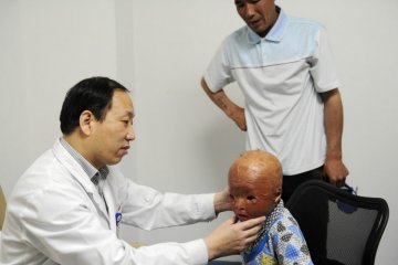 宁夏烧伤男孩王小鹏北京医治之旅