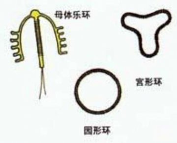 女性上避孕环全过程