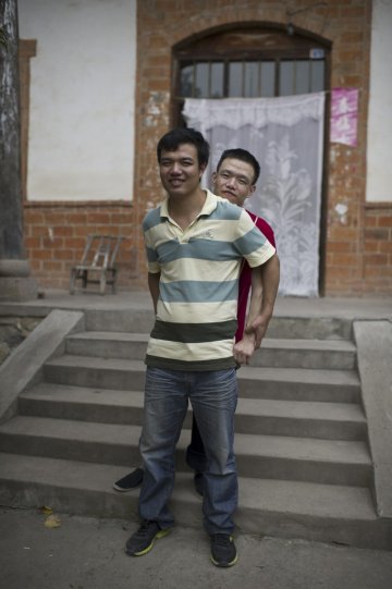 罕见病：帕金森患者的故事