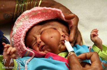 印度双面女婴死亡