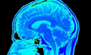 英科学家用扫描技术成功读取大脑记忆