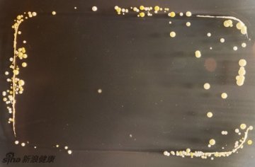 手机暗藏大量细菌 这是显微镜下的景象