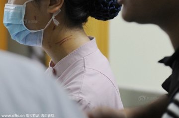 护士遭患儿家长打 因输液未“一针见血”