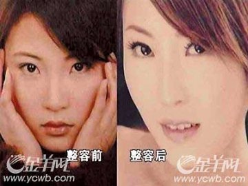 河北第一人造美女状告整容医院