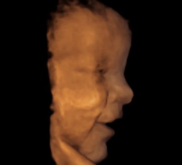 英准妈妈借3D影像窥探腹中子