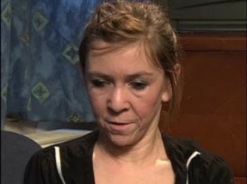 15岁少女患怪病长45岁脸