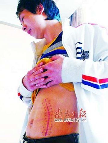 “卖肾”者自白揭肮脏交易链
