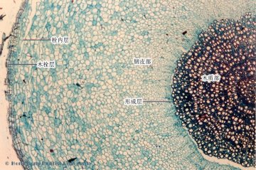 远志（Yuanzhi）中药材横切面显微鉴别照片