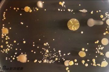 手机暗藏大量细菌 这是显微镜下的景象