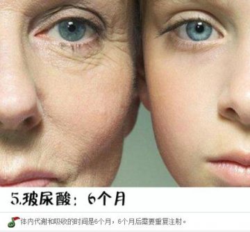 整形手术保质期大揭秘