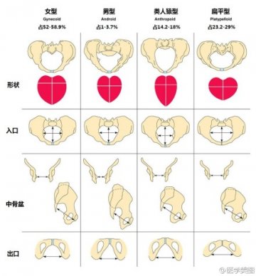 信息图：女性骨盆分型