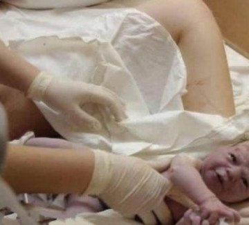 实拍孕妇顺产惊心全过程