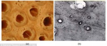 藤与人骨生物相容性好 或成新的人造骨替代材料