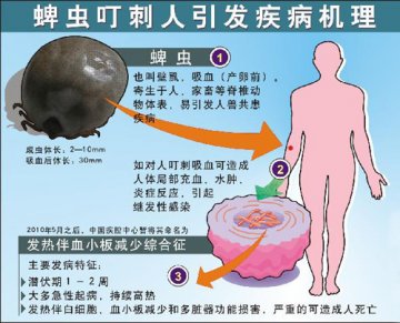 河南商城蜱虫咬人致死者名单公开仍遭拒绝 盘点蜱虫相关信息