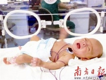 女婴出生时体重仅600克 3个月后可自主呼吸