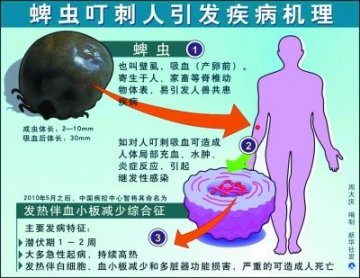 野外活动须防蜱虫咬人致死 被叮之后不要用力抠