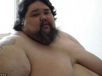 男子体重400kg躺家中5年寸步难移