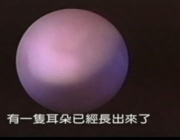 实拍少女人流全过程
