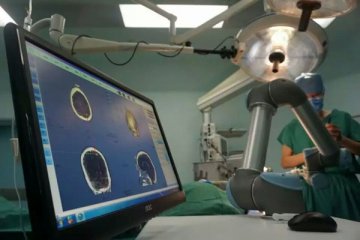 第306医院成功开展国内首例机器人辅助脑囊虫摘除术