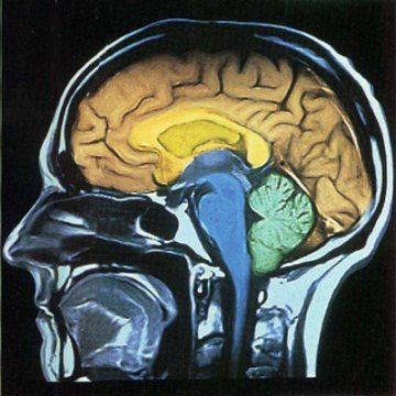 人体的12个“缺陷” 你发现了吗