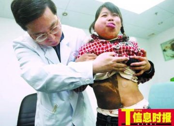 全球最恐怖的67种怪病