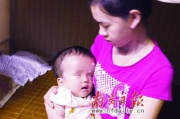 婴儿脑积水父母无钱为其医治 将错过黄金治疗期