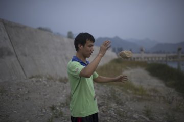 罕见病：帕金森患者的故事