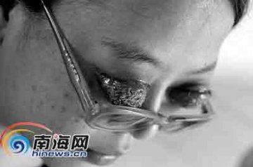 全球最恐怖的67种怪病