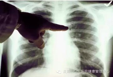体检发现肺结节就一定是癌症吗？