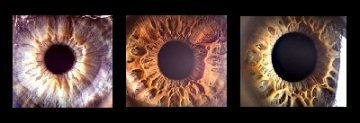 美科学家利用iPhone检查眼部健康