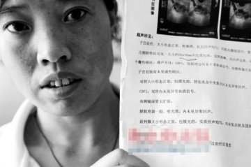 女患者B超报告称