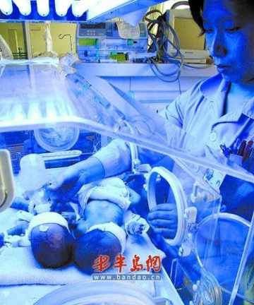 产妇生下三胞胎取名奥奥运运会会
